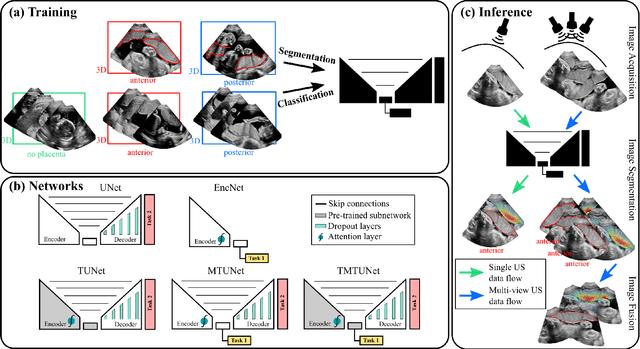 Figure 3 for Placenta Segmentation in Ultrasound Imaging: Addressing Sources of Uncertainty and Limited Field-of-View