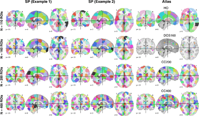 Figure 3 for Ensemble learning with 3D convolutional neural networks for connectome-based prediction