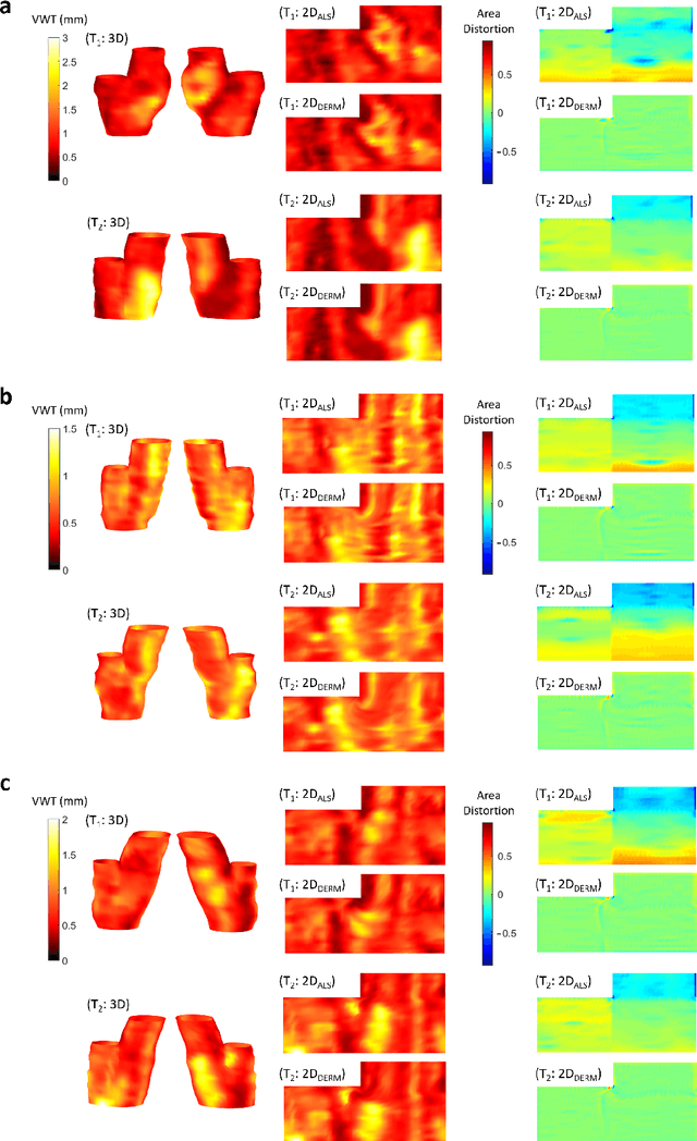 Figure 2 for Area-preserving mapping of 3D ultrasound carotid artery images using density-equalizing reference map