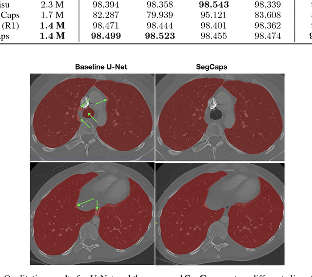 Figure 3 for Capsules for Object Segmentation