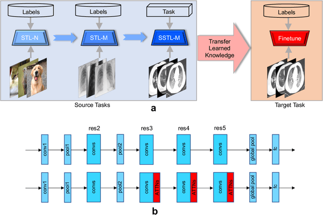 Figure 1 for A Multi-Stage Attentive Transfer Learning Framework for Improving COVID-19 Diagnosis