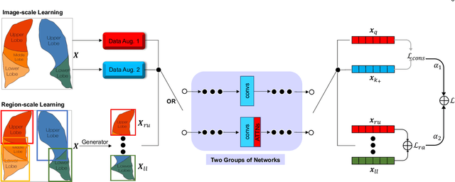 Figure 3 for A Multi-Stage Attentive Transfer Learning Framework for Improving COVID-19 Diagnosis