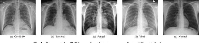 Figure 1 for Covid-19 Detection from Chest X-ray and Patient Metadata using Graph Convolutional Neural Networks