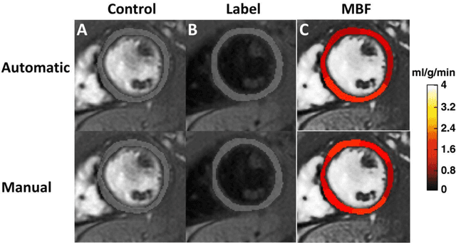 Figure 2 for Accuracy, Uncertainty, and Adaptability of Automatic Myocardial ASL Segmentation using Deep CNN