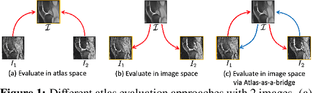 Figure 1 for Aladdin: Joint Atlas Building and Diffeomorphic Registration Learning with Pairwise Alignment