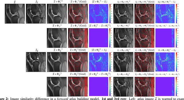 Figure 3 for Aladdin: Joint Atlas Building and Diffeomorphic Registration Learning with Pairwise Alignment