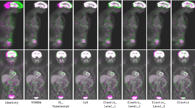 Figure 3 for Deformable Image Registration with Deep Network Priors: a Study on Longitudinal PET Images