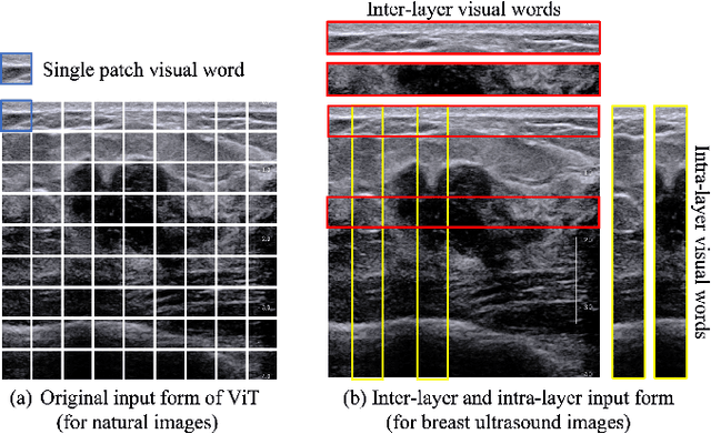 Figure 3 for HoVer-Trans: Anatomy-aware HoVer-Transformer for ROI-free Breast Cancer Diagnosis in Ultrasound Images