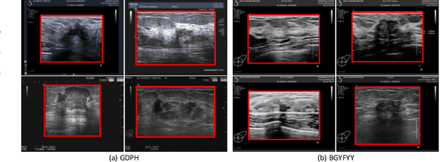 Figure 4 for HoVer-Trans: Anatomy-aware HoVer-Transformer for ROI-free Breast Cancer Diagnosis in Ultrasound Images