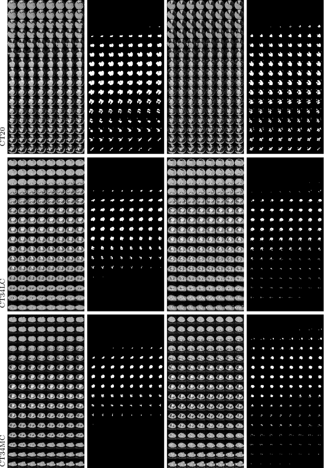 Figure 4 for Fed-Sim: Federated Simulation for Medical Imaging