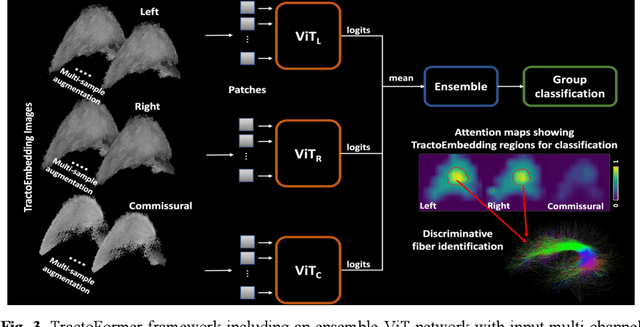 Figure 4 for TractoFormer: A Novel Fiber-level Whole Brain Tractography Analysis Framework Using Spectral Embedding and Vision Transformers