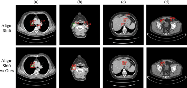 Figure 3 for Conditional Training with Bounding Map for Universal Lesion Detection