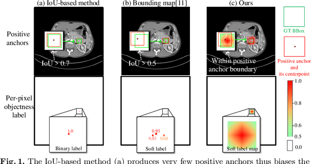 Figure 1 for Conditional Training with Bounding Map for Universal Lesion Detection