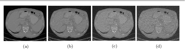 Figure 3 for Deep Learning for Low-Dose CT Denoising
