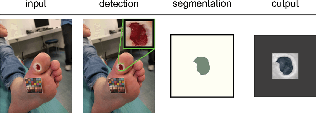 Figure 1 for Detect-and-Segment: a Deep Learning Approach to Automate Wound Image Segmentation