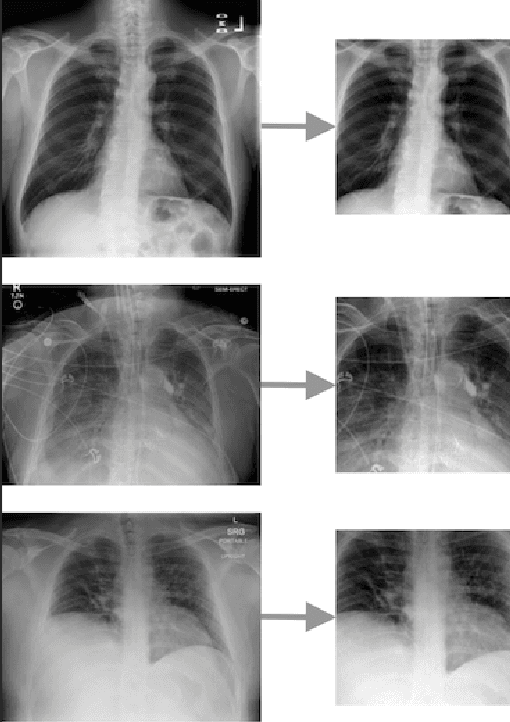 Figure 3 for CovXR: Automated Detection of COVID-19 Pneumonia in Chest X-Rays through Machine Learning