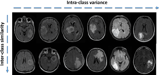 Figure 1 for SAGE: Sequential Attribute Generator for Analyzing Glioblastomas using Limited Dataset