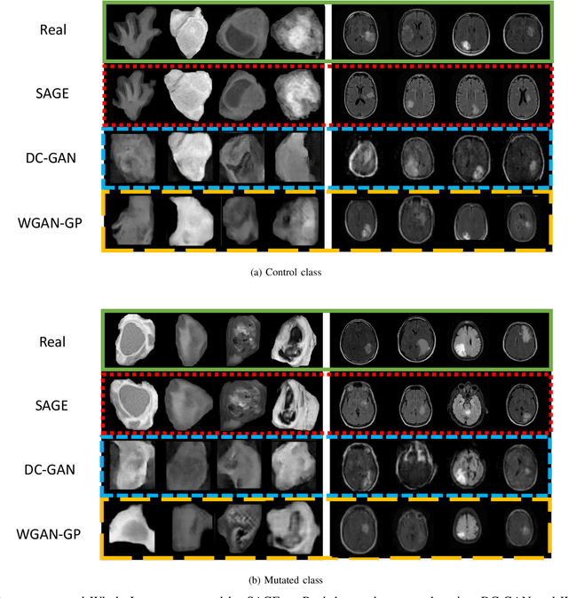 Figure 4 for SAGE: Sequential Attribute Generator for Analyzing Glioblastomas using Limited Dataset