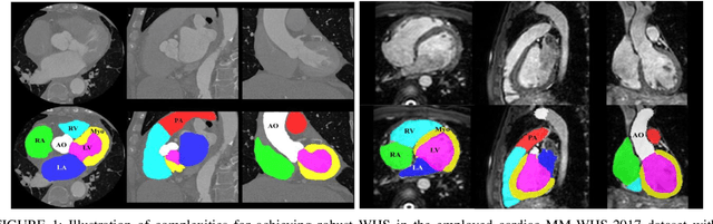 Figure 1 for Multi-class probabilistic atlas-based whole heart segmentation method in cardiac CT and MRI