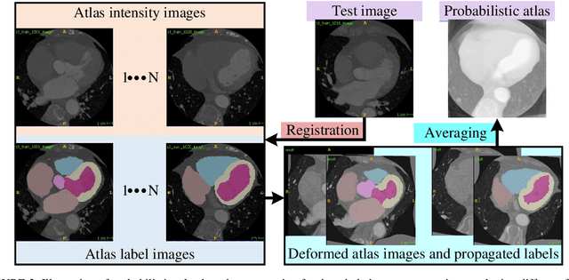 Figure 3 for Multi-class probabilistic atlas-based whole heart segmentation method in cardiac CT and MRI