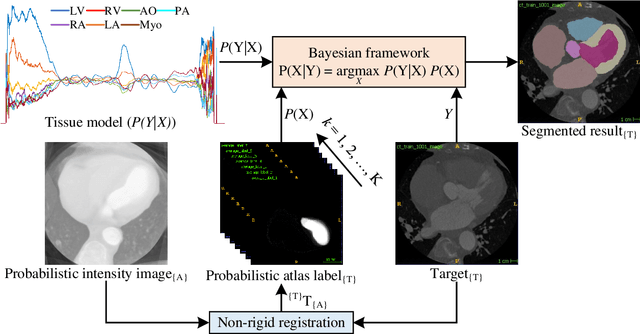 Figure 4 for Multi-class probabilistic atlas-based whole heart segmentation method in cardiac CT and MRI
