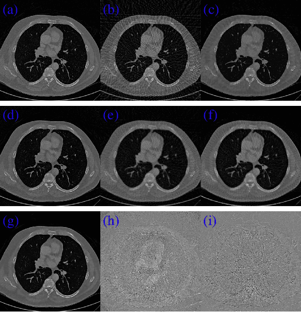 Figure 2 for JSR-Net: A Deep Network for Joint Spatial-Radon Domain CT Reconstruction from incomplete data