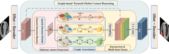 Figure 1 for Graph-based Pyramid Global Context Reasoning with a Saliency-aware Projection for COVID-19 Lung Infections Segmentation