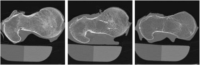 Figure 2 for Introducing Anisotropic Minkowski Functionals for Local Structure Analysis and Prediction of Biomechanical Strength of Proximal Femur Specimens