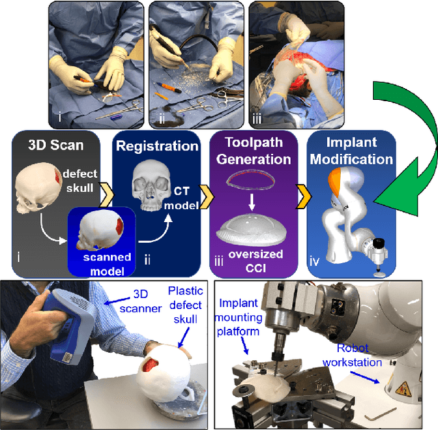 Figure 1 for A Robotic System for Implant Modification in Single-stage Cranioplasty