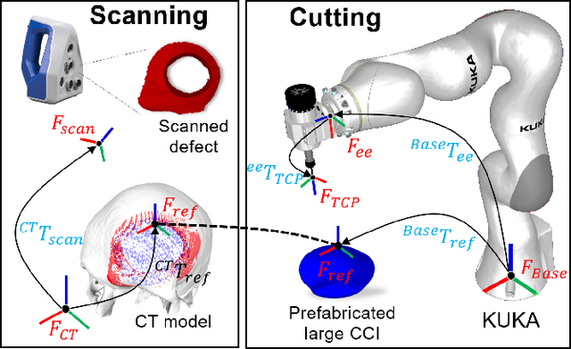 Figure 2 for A Robotic System for Implant Modification in Single-stage Cranioplasty