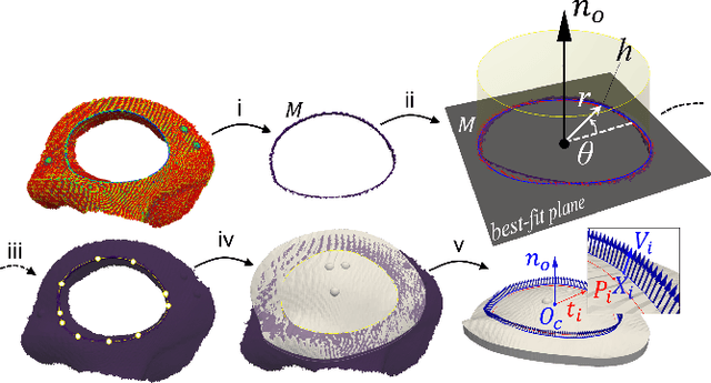 Figure 3 for A Robotic System for Implant Modification in Single-stage Cranioplasty