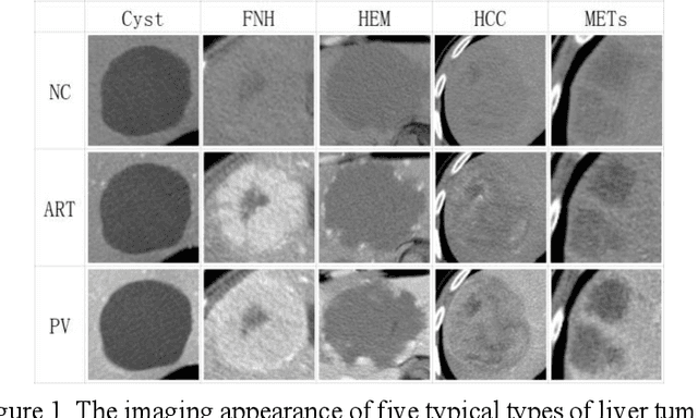 Figure 1 for PA-ResSeg: A Phase Attention Residual Network for Liver Tumor Segmentation from Multi-phase CT Images