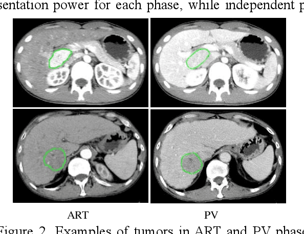 Figure 3 for PA-ResSeg: A Phase Attention Residual Network for Liver Tumor Segmentation from Multi-phase CT Images