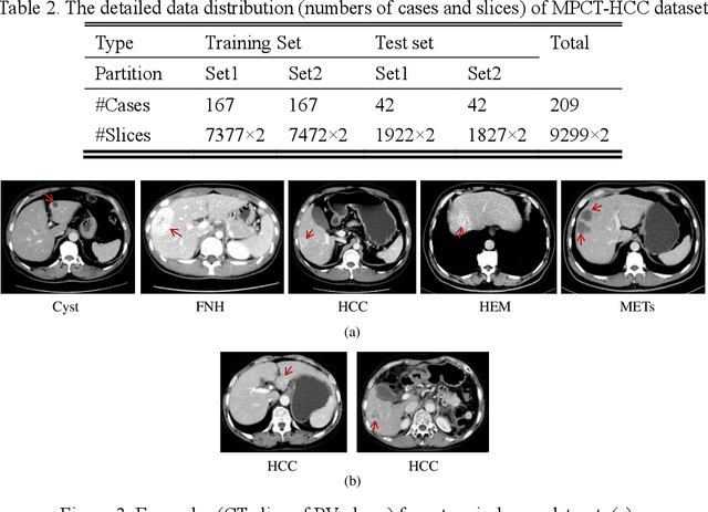 Figure 4 for PA-ResSeg: A Phase Attention Residual Network for Liver Tumor Segmentation from Multi-phase CT Images