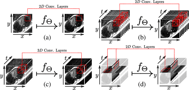 Figure 1 for Spatio-Temporal Deep Learning-Based Undersampling Artefact Reduction for 2D Radial Cine MRI with Limited Data