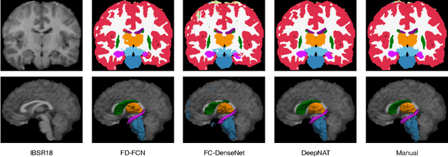 Figure 3 for FD-FCN: 3D Fully Dense and Fully Convolutional Network for Semantic Segmentation of Brain Anatomy