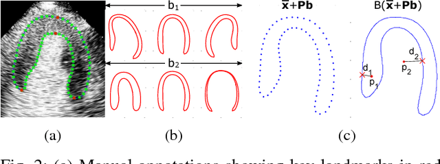 Figure 2 for Fully Automatic Myocardial Segmentation of Contrast Echocardiography Sequence Using Random Forests Guided by Shape Model