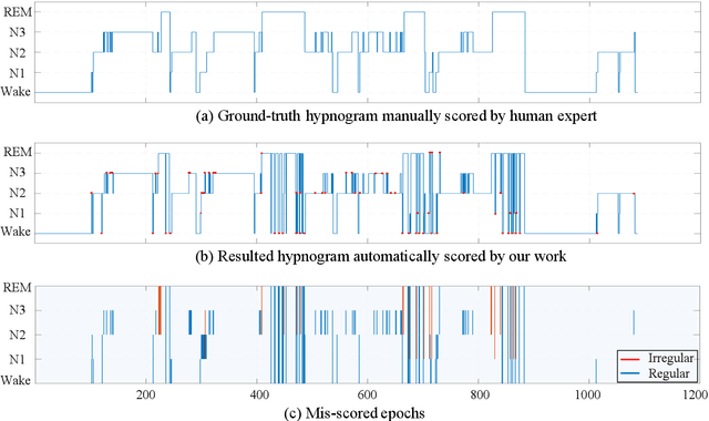 Figure 2 for Enhancement on Model Interpretability and Sleep Stage Scoring Performance with A Novel Pipeline Based on Deep Neural Network