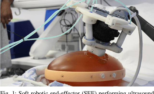 Figure 1 for Design and integration of a parallel, soft robotic end-effector for extracorporeal ultrasound