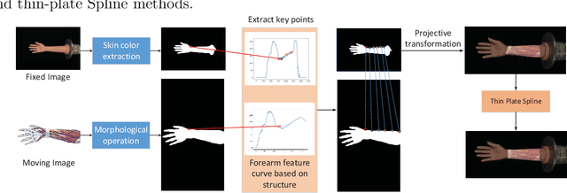Figure 1 for A Structure Feature Algorithm for Multi-modal Forearm Registration