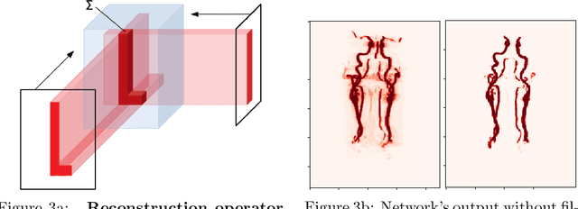 Figure 3 for Random 2.5D U-net for Fully 3D Segmentation