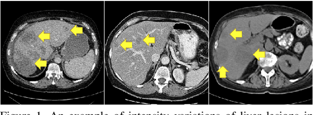 Figure 1 for T-AutoML: Automated Machine Learning for Lesion Segmentation using Transformers in 3D Medical Imaging