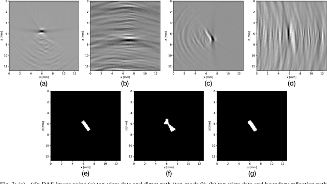 Figure 3 for Deep Learning for Multi-View Ultrasonic Image Fusion