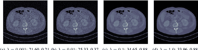 Figure 3 for End-to-end reconstruction meets data-driven regularization for inverse problems