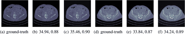 Figure 4 for End-to-end reconstruction meets data-driven regularization for inverse problems