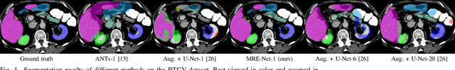 Figure 4 for A Unified Framework for Generalized Low-Shot Medical Image Segmentation with Scarce Data