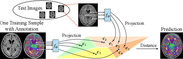 Figure 1 for A Unified Framework for Generalized Low-Shot Medical Image Segmentation with Scarce Data