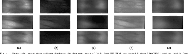 Figure 4 for From Noise to Feature: Exploiting Intensity Distribution as a Novel Soft Biometric Trait for Finger Vein Recognition