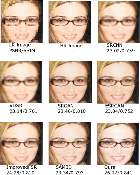 Figure 2 for Frequency Aware Face Hallucination Generative Adversarial Network with Semantic Structural Constraint