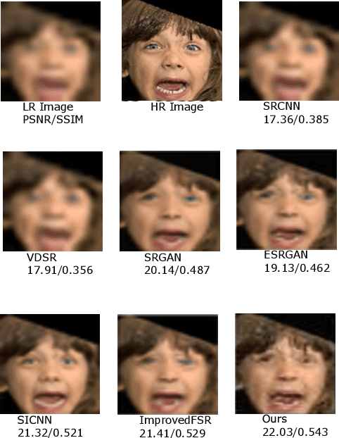 Figure 4 for Frequency Aware Face Hallucination Generative Adversarial Network with Semantic Structural Constraint